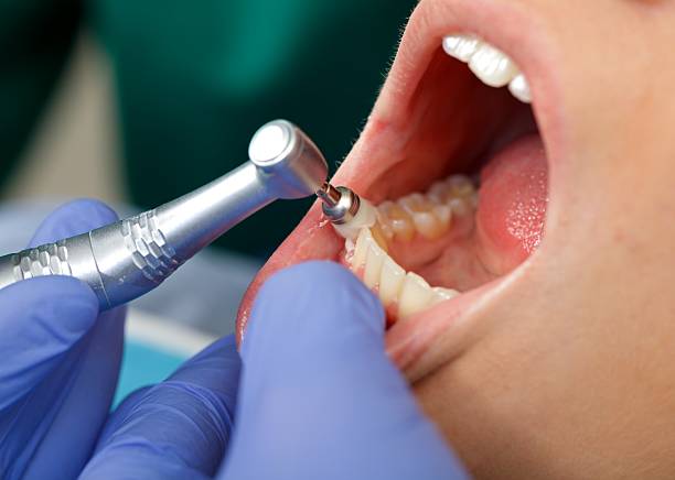 dental custodian in action